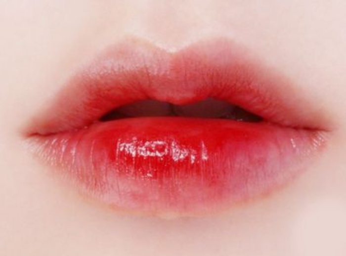 Image Source